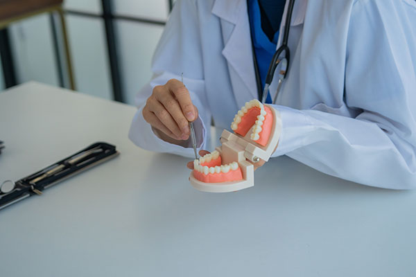 Possible Complications Of Root Canals And How To Avoid Them